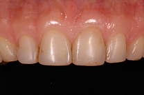 &Auml;sthetische Zahnmedizin