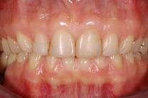 &Auml;sthetische Zahnmedizin