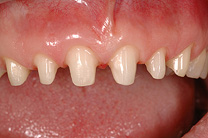 &Auml;sthetische Zahnmedizin