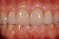 &Auml;sthetische Zahnmedizin